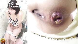 shart videos