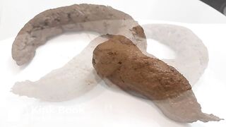 The "Question Mark" Poop