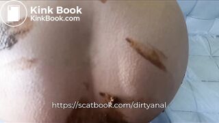 very very dirty anal with a lot of poop