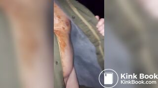 Winter scat flashing