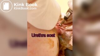 Scat urethra until anal urination
