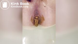 My own scat