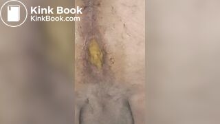 Winter scat flashing