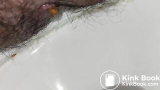 Close-up view of my anus while shitting