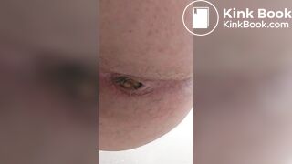 Amateur poo