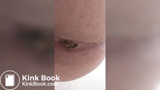 Amateur poo
