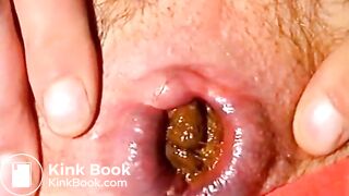 Scat - CloseupShitting