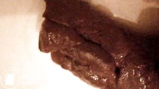 Scat - TurdPlay