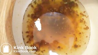 2015-02-17 diarrhea