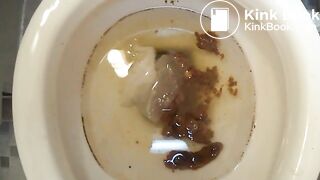 2015-02-17 shitty ass inspection