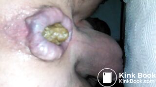 Shitting chunky turd