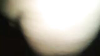 sct (75)