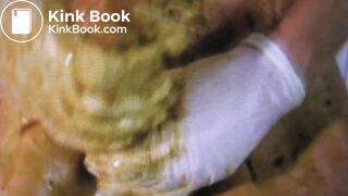 shit smearing madness part 3