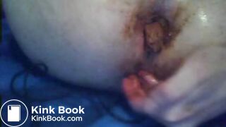 dirty anal scat