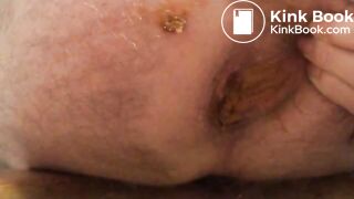 2015-12-20 all day diarrhea