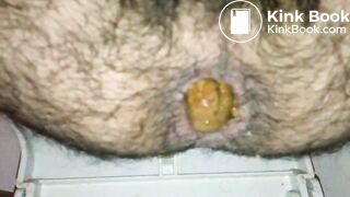 Turd_1