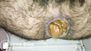 Turd_1