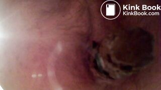 Video 35