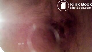 Video 35