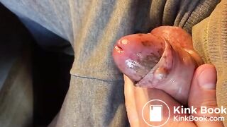 scat expulsion from urethra