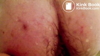 Video 78