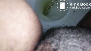 1122018 Poop