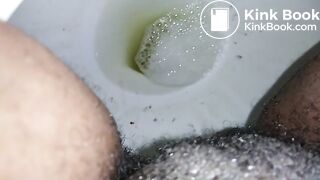 1122018 Poop