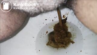 Toilet Shit 12232017