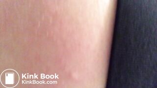 Runny poop at my sister's