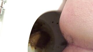 Runny poop at my sister's