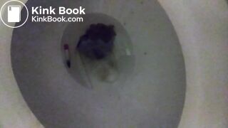 Toilet Poop 4252018