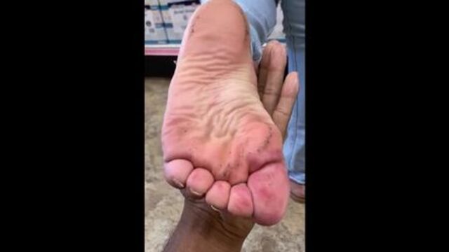 Iris has gunk all on her soles