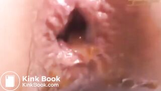 scat