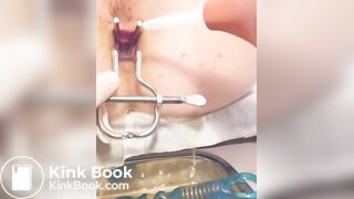 Urine sample at gynecology part 2/B