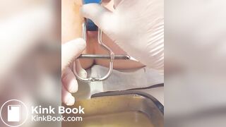 Urine sample at gynecology part 2/B