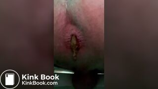 Big shit in your face