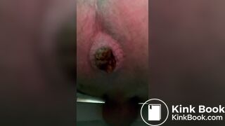 Big shit in your face