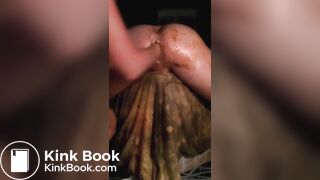 Getting the Shit Fisted out of my Ass