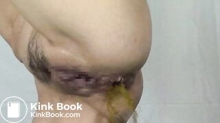 Shitty enema and fist on a hairy Asian girl