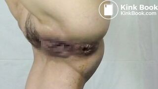 Shitty enema and fist on a hairy Asian girl