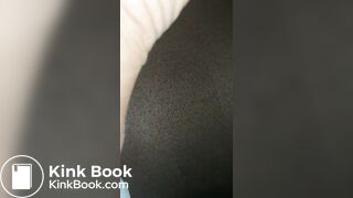 Anal scat