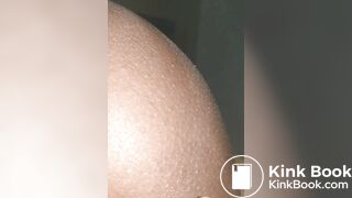 Anal scat