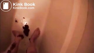 Diarrhea covers her legs