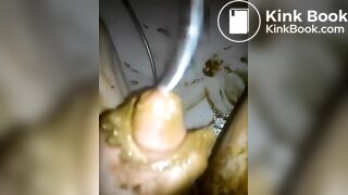 scat pig shit eater