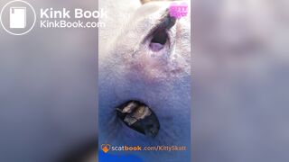 Dixie POV massive shits