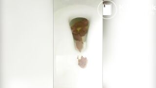 SCAT - Hot girls Pooping