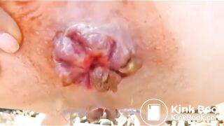 SCAT - Sexy girls Pooping 44