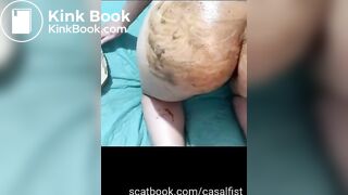 casalfist 07/05/2022