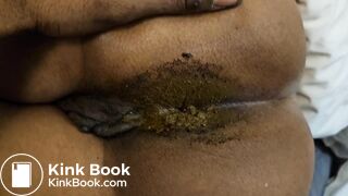 Gfs Dirty asshole on display