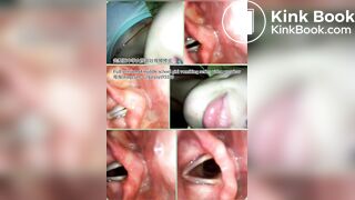 Girl Vomiting Series 2